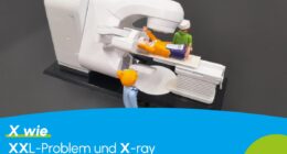 XXL-Problem und X-ray